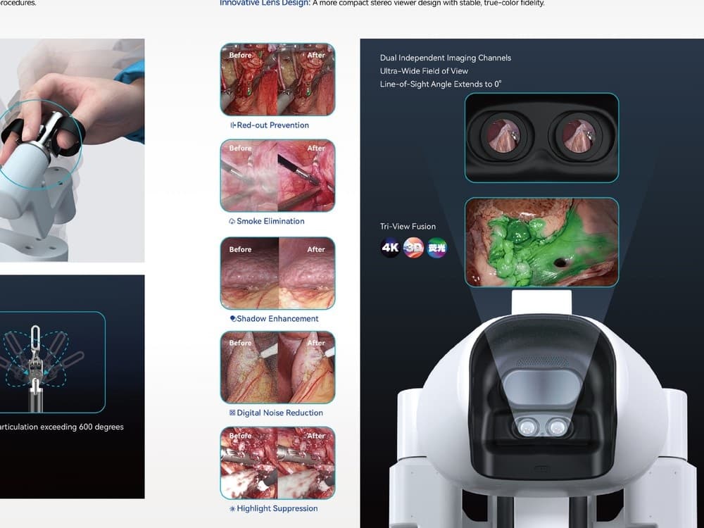 ARES 6G Laparoscopic Surgical Robot System